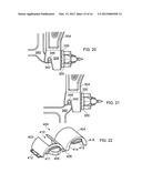 APPARATUS FOR IMAGING A BODY PART diagram and image