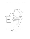 System and Method for Determining Patient Follow-Up Subsequent to an     Orthopaedic Procedure diagram and image