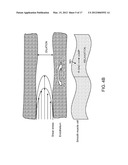 Macro/Micro Duty Cycle Devices, Systems, and Methods Employing     Low-Frequency Ultrasound or Other Cyclical Pressure Energies diagram and image