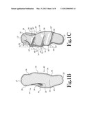 Hand Held Orthosis Having A Flexible Enclosure And Method Of Utilization diagram and image