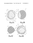 Hand Held Orthosis Having A Flexible Enclosure And Method Of Utilization diagram and image