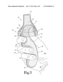 Hand Held Orthosis Having A Flexible Enclosure And Method Of Utilization diagram and image