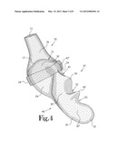 Hand Held Orthosis Having A Flexible Enclosure And Method Of Utilization diagram and image