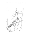 ADJUSTABLE DORSAL NIGHT SPLINT diagram and image