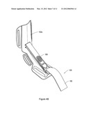 ADJUSTABLE DORSAL NIGHT SPLINT diagram and image