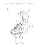 ADJUSTABLE DORSAL NIGHT SPLINT diagram and image