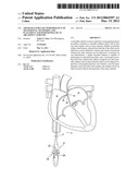 APPARATUS FOR SAFE PERFORMANCE OF TRANSSEPTAL TECHNIQUE AND PLACEMENT AND     POSITIONING OF AN ABLATION CATHETER diagram and image