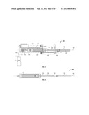 Delivery system for injection through zone of body diagram and image