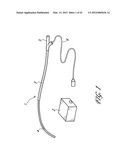 SYSTEMS AND METHODS FOR TREATING A HOLLOW ANATOMICAL STRUCTURE diagram and image