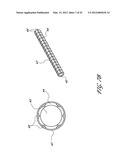 SYSTEMS AND METHODS FOR TREATING A HOLLOW ANATOMICAL STRUCTURE diagram and image