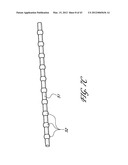 SYSTEMS AND METHODS FOR TREATING A HOLLOW ANATOMICAL STRUCTURE diagram and image