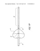 SYSTEMS AND METHODS FOR TREATING A HOLLOW ANATOMICAL STRUCTURE diagram and image