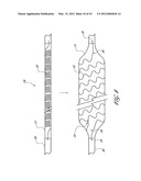 SYSTEMS AND METHODS FOR TREATING A HOLLOW ANATOMICAL STRUCTURE diagram and image