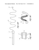 SYSTEMS AND METHODS FOR TREATING A HOLLOW ANATOMICAL STRUCTURE diagram and image