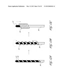 SYSTEMS AND METHODS FOR TREATING A HOLLOW ANATOMICAL STRUCTURE diagram and image