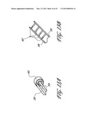 SYSTEMS AND METHODS FOR TREATING A HOLLOW ANATOMICAL STRUCTURE diagram and image