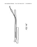 SYSTEMS AND METHODS FOR TREATING A HOLLOW ANATOMICAL STRUCTURE diagram and image