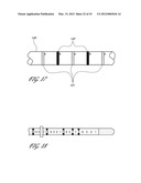 SYSTEMS AND METHODS FOR TREATING A HOLLOW ANATOMICAL STRUCTURE diagram and image