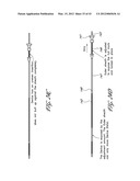 SYSTEMS AND METHODS FOR TREATING A HOLLOW ANATOMICAL STRUCTURE diagram and image