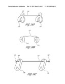 SYSTEMS AND METHODS FOR TREATING A HOLLOW ANATOMICAL STRUCTURE diagram and image