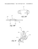 SYSTEMS AND METHODS FOR TREATING A HOLLOW ANATOMICAL STRUCTURE diagram and image