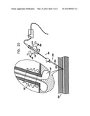 METHODS AND APPARATUS FOR HEMOSTASIS FOLLOWING ARTERIAL CATHETERIZATION diagram and image