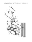 METHODS AND APPARATUS FOR HEMOSTASIS FOLLOWING ARTERIAL CATHETERIZATION diagram and image