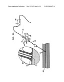 METHODS AND APPARATUS FOR HEMOSTASIS FOLLOWING ARTERIAL CATHETERIZATION diagram and image