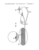 METHODS AND APPARATUS FOR HEMOSTASIS FOLLOWING ARTERIAL CATHETERIZATION diagram and image