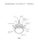 TISSUE MODIFICATION DEVICES diagram and image