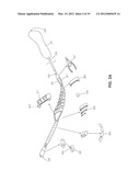 TISSUE MODIFICATION DEVICES diagram and image