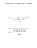 TISSUE MODIFICATION DEVICES diagram and image