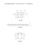 TISSUE MODIFICATION DEVICES diagram and image