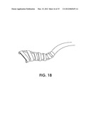 TISSUE MODIFICATION DEVICES diagram and image