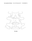 TISSUE MODIFICATION DEVICES diagram and image