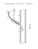 SYSTEM AND METHOD FOR VESSEL ACCESS CLOSURE diagram and image