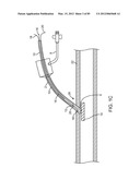 SYSTEM AND METHOD FOR VESSEL ACCESS CLOSURE diagram and image