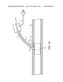 SYSTEM AND METHOD FOR VESSEL ACCESS CLOSURE diagram and image