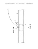 SYSTEM AND METHOD FOR VESSEL ACCESS CLOSURE diagram and image