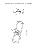 SYSTEM AND METHOD FOR VESSEL ACCESS CLOSURE diagram and image