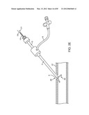 SYSTEM AND METHOD FOR VESSEL ACCESS CLOSURE diagram and image