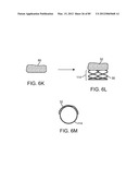 SYSTEM AND METHOD FOR VESSEL ACCESS CLOSURE diagram and image