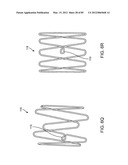 SYSTEM AND METHOD FOR VESSEL ACCESS CLOSURE diagram and image