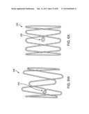 SYSTEM AND METHOD FOR VESSEL ACCESS CLOSURE diagram and image