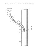 SYSTEM AND METHOD FOR VESSEL ACCESS CLOSURE diagram and image