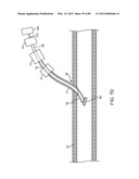 SYSTEM AND METHOD FOR VESSEL ACCESS CLOSURE diagram and image