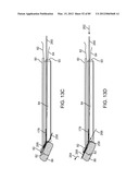 SYSTEM AND METHOD FOR VESSEL ACCESS CLOSURE diagram and image