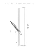 SYSTEM AND METHOD FOR VESSEL ACCESS CLOSURE diagram and image