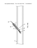 SYSTEM AND METHOD FOR VESSEL ACCESS CLOSURE diagram and image