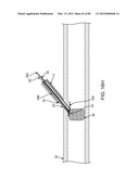 SYSTEM AND METHOD FOR VESSEL ACCESS CLOSURE diagram and image